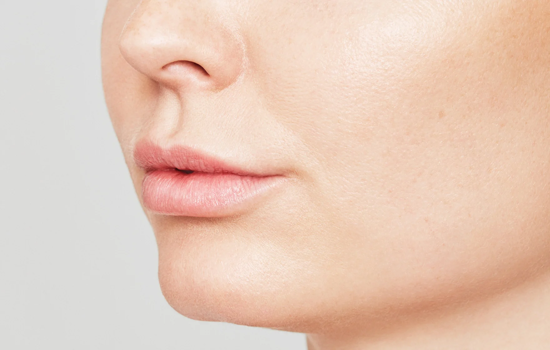 Changed proportions of the lips