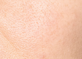skin_texture