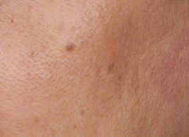 skin_tone